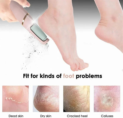 Rechargeable Electric Foot Callus Remover for Smooth Skin