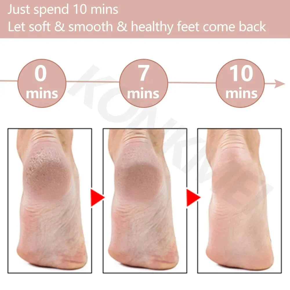 Rechargeable Electric Foot Callus Remover for Smooth Skin